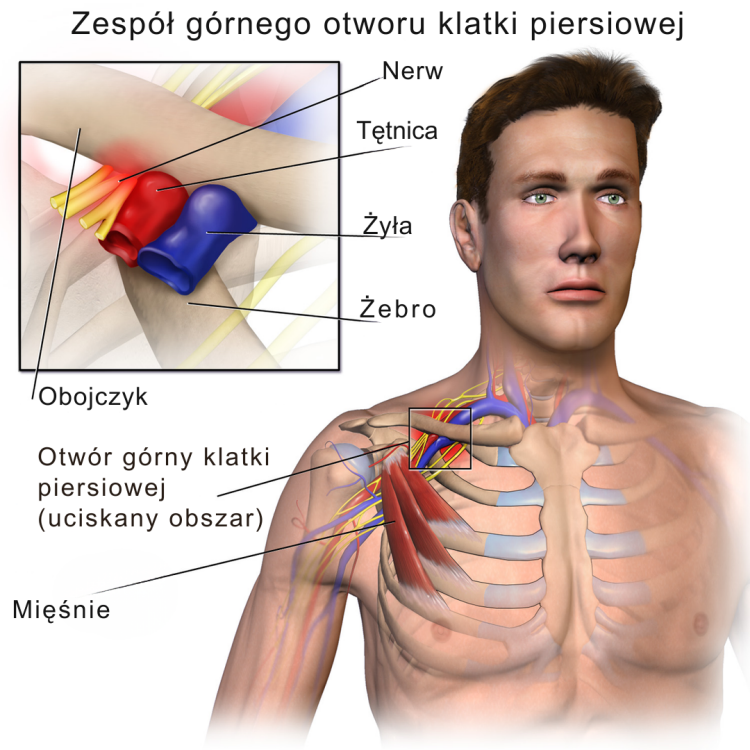 Grafika, mężczyzna, klatka piersiowa, zespół górnego otworu klatki piersiowej