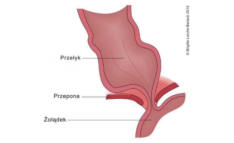 żołądek, przełyk, przepona