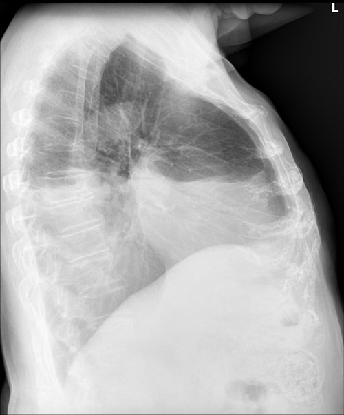 zdjęcie RTG płuca kręgosłup szkielet