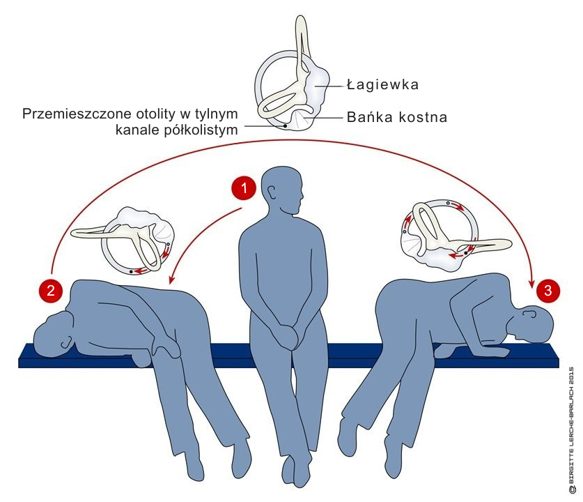 Ilustracja przedstawiająca jak krok po kroku wykonać Manewr Semonta