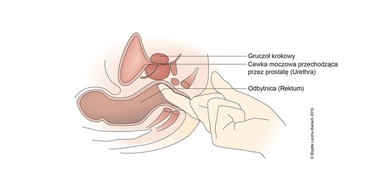 Ilustracja badanie per rectum